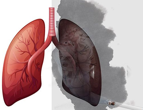肺炎的症状有哪些症状，肺炎除了呼吸困难，还有这3点症状