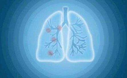 白肺是可以治愈的吗（白肺是可以治愈的吗吃什么药）