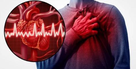心肌炎做什么检查能查出来（心肌炎做什么检查能查出来?）