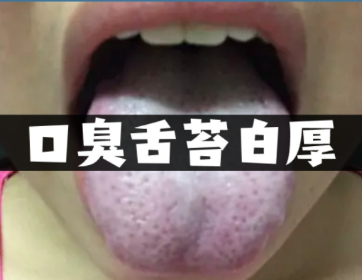 舌苔厚白是什么原因引起的怎么解决（舌苔厚白是什么原因引起的怎么解决女人）