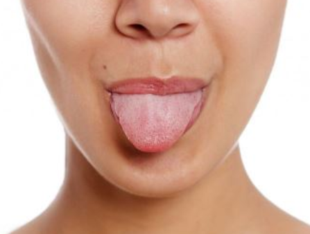 舌苔厚白是什么原因引起的怎么解决