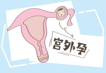 宫外怀孕怎么处理（结扎了还可以恢复生育能力吗）
