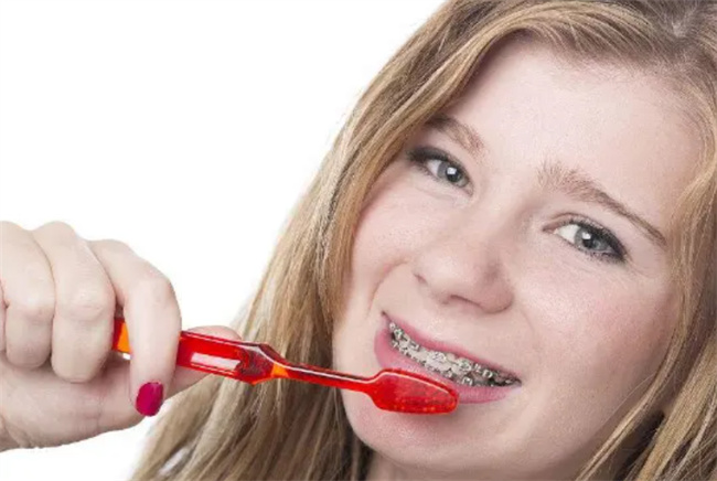 戴牙套是不是吃完饭就要刷牙