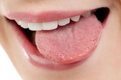舌头发白是什么原因