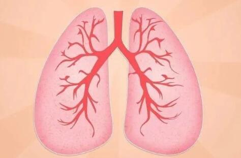 肺结核有哪些症状表现（老人肺结核症状及表现）