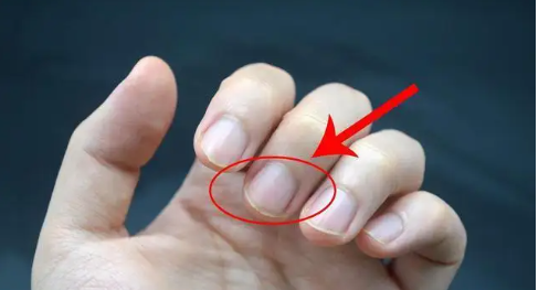 指甲有竖纹是身体的什么信号（指甲有竖纹）
